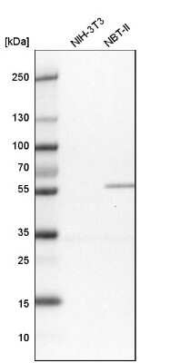 Western Blot: PGM3 Antibody [NBP1-89208]