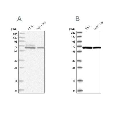 Western Blot: PGM3 Antibody [NBP1-89208]