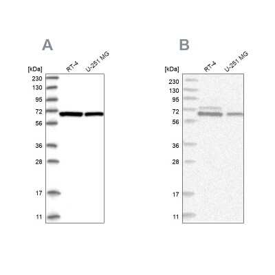 Western Blot: PGM3 Antibody [NBP1-89209]
