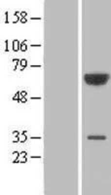 Western Blot: PGM3 Overexpression Lysate [NBL1-14340]