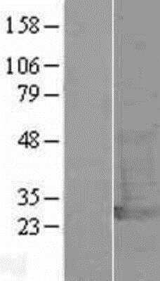 Western Blot: UCH-L1/PGP9.5 Overexpression Lysate [NBL1-17575]