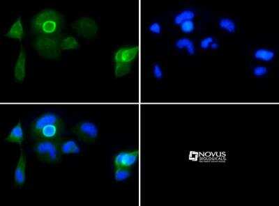 Immunocytochemistry/ Immunofluorescence: UCH-L1/PGP9.5 Antibody [NB300-676]