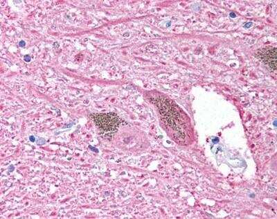 Immunohistochemistry-Paraffin: UCH-L1/PGP9.5 Antibody [NB300-676]