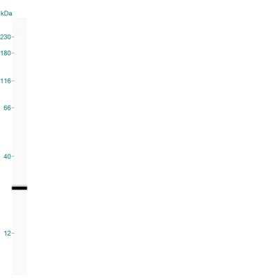 Simple Western: UCH-L1/PGP9.5 Antibody [NB300-676]