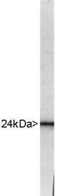 Western Blot: UCH-L1/PGP9.5 Antibody [NB110-58874]