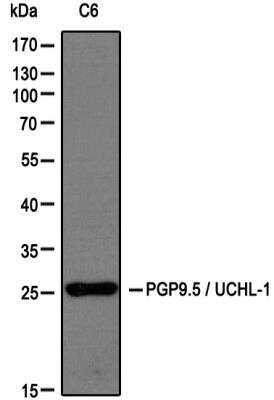 Western Blot: UCH-L1/PGP9.5 Antibody [NB300-675]