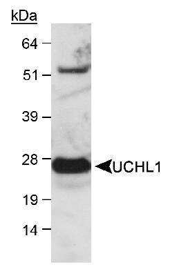 Western Blot: UCH-L1/PGP9.5 Antibody [NB300-676]