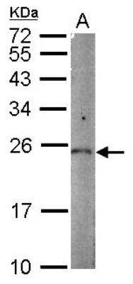 Western Blot: PGPEP-1 Antibody [NBP2-19788]