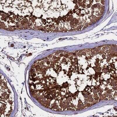 Immunohistochemistry-Paraffin: PGPEP1L Antibody [NBP1-90971]