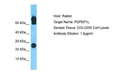 Western Blot: PGPEP1L Antibody [NBP2-83385]