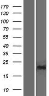 Western Blot: PGPEP1L Overexpression Lysate [NBP2-08243]