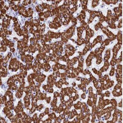 Immunohistochemistry: PGPase Antibody [NBP2-30701]