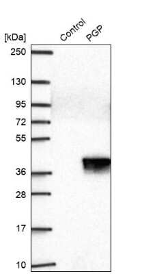 Western Blot: PGPase Antibody [NBP2-30701]