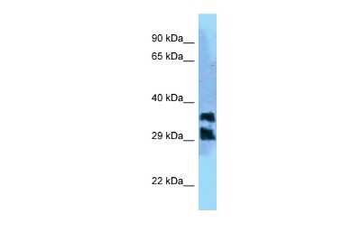 Western Blot: PGPase Antibody [NBP2-85469]