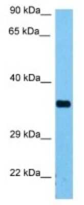 Western Blot: PGPase Antibody [NBP3-10105]