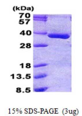 SDS-PAGE: Recombinant Human PGPase His Protein [NBP2-23328]