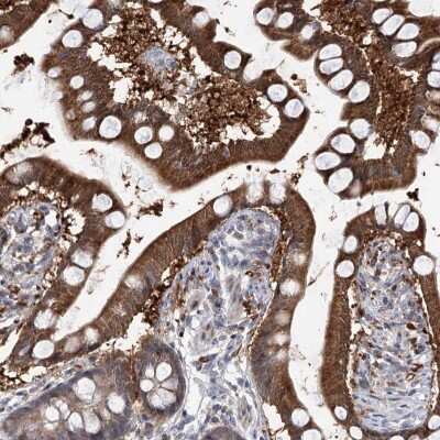 Immunohistochemistry-Paraffin: PGR1 Antibody [NBP1-87892]