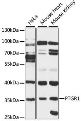 Western Blot: PGR1 AntibodyAzide and BSA Free [NBP2-93146]