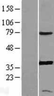 Western Blot: PGR1 Overexpression Lysate [NBL1-14941]