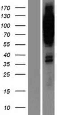 Western Blot: Progesterone R/NR3C3 Overexpression Lysate [NBP2-10714]