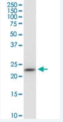 Western Blot: PGRMC1 Antibody (3F7) [H00010857-M03-100ug]
