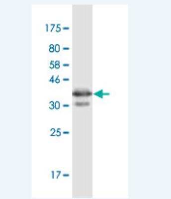 Western Blot: PGRMC1 Antibody (3F7) [H00010857-M03-100ug]