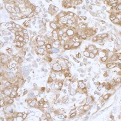 Immunohistochemistry: PGRMC1 Antibody [NBP2-36525]