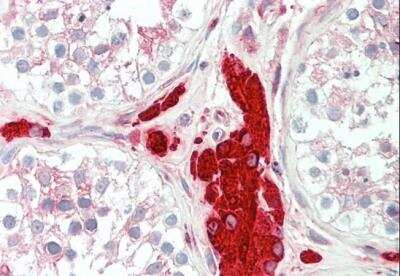 Immunohistochemistry-Paraffin: PGRMC1 Antibody [NB100-2841]