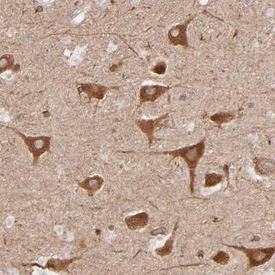 Immunohistochemistry-Paraffin: PGRMC1 Antibody [NBP1-83220]