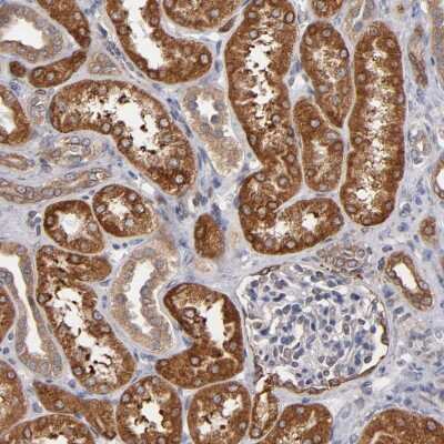 Immunohistochemistry-Paraffin: PGRMC1 Antibody [NBP1-83220]