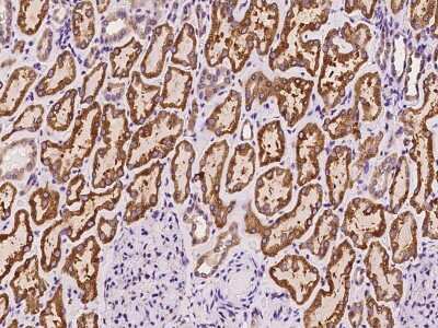 Immunohistochemistry-Paraffin: PGRMC1 Antibody [NBP2-97696]