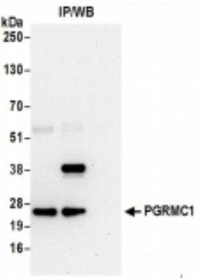 Immunoprecipitation: PGRMC1 Antibody [NBP2-36525]