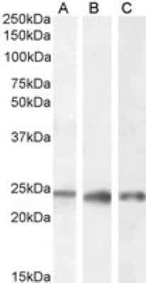 Western Blot: PGRMC1 Antibody [NB100-2841]