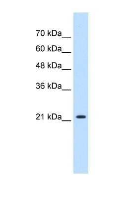 Western Blot: PGRMC1 Antibody [NBP1-59827]