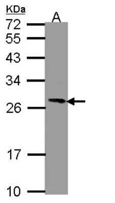 Western Blot: PGRMC1 Antibody [NBP2-19789]