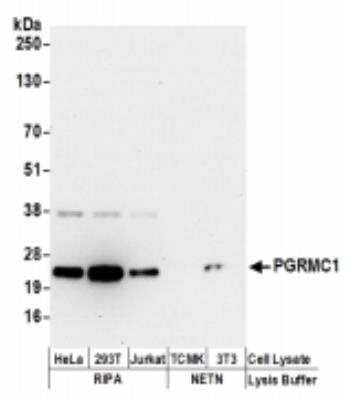 Western Blot: PGRMC1 Antibody [NBP2-36525]