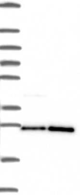 Western Blot: PGRMC1 Antibody [NBP3-17641]