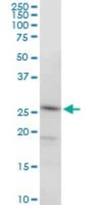 Western Blot: PGRMC2 Antibody (2A3) [H00010424-M03]