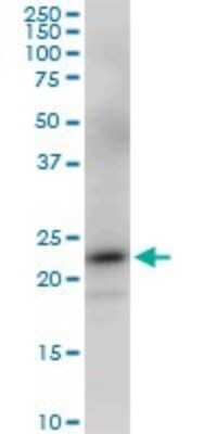 Western Blot: PGRMC2 Antibody (2A3) [H00010424-M03]