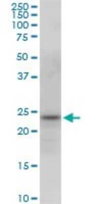 Western Blot: PGRMC2 Antibody (2A3) [H00010424-M03]