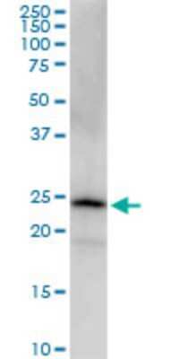 Western Blot: PGRMC2 Antibody (2A3) [H00010424-M03]
