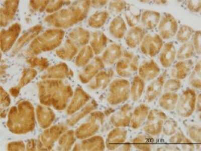 Immunohistochemistry-Paraffin: PGRMC2 Antibody (3C11) [H00010424-M04]