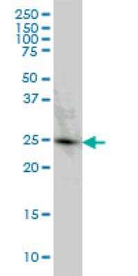 Western Blot: PGRMC2 Antibody (3C11) [H00010424-M04]