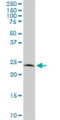 Western Blot: PGRMC2 Antibody (3C11) [H00010424-M04]