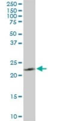 Western Blot: PGRMC2 Antibody (3C11) [H00010424-M04]