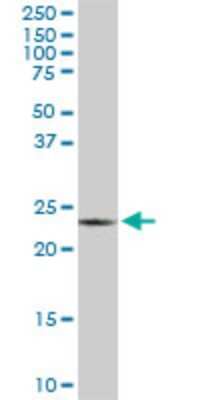 Western Blot: PGRMC2 Antibody (3C11) [H00010424-M04]