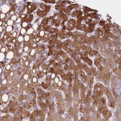 Immunohistochemistry-Paraffin: PGRMC2 Antibody [NBP2-13753]