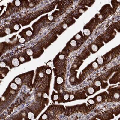 Immunohistochemistry-Paraffin: PGRMC2 Antibody [NBP2-49289]