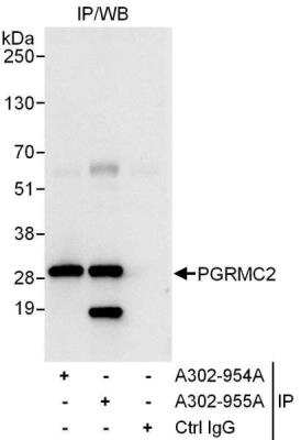 Immunoprecipitation: PGRMC2 Antibody [NBP1-49716]