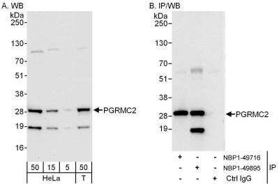 Western Blot: PGRMC2 Antibody [NBP1-49895]